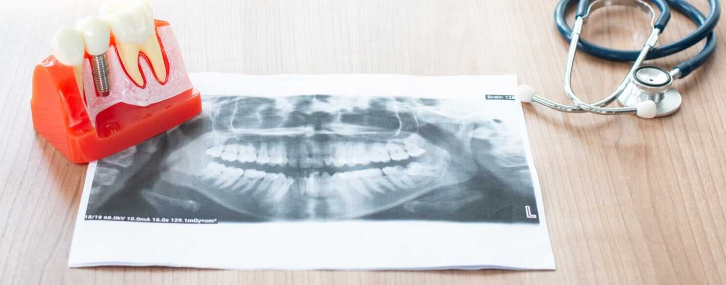 ROS - Radiologia Odontológica Sorocaba
